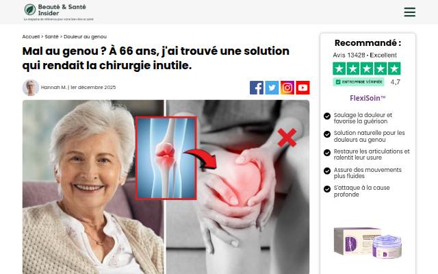 Montra da Felxison Knee Pani Cream Adv
