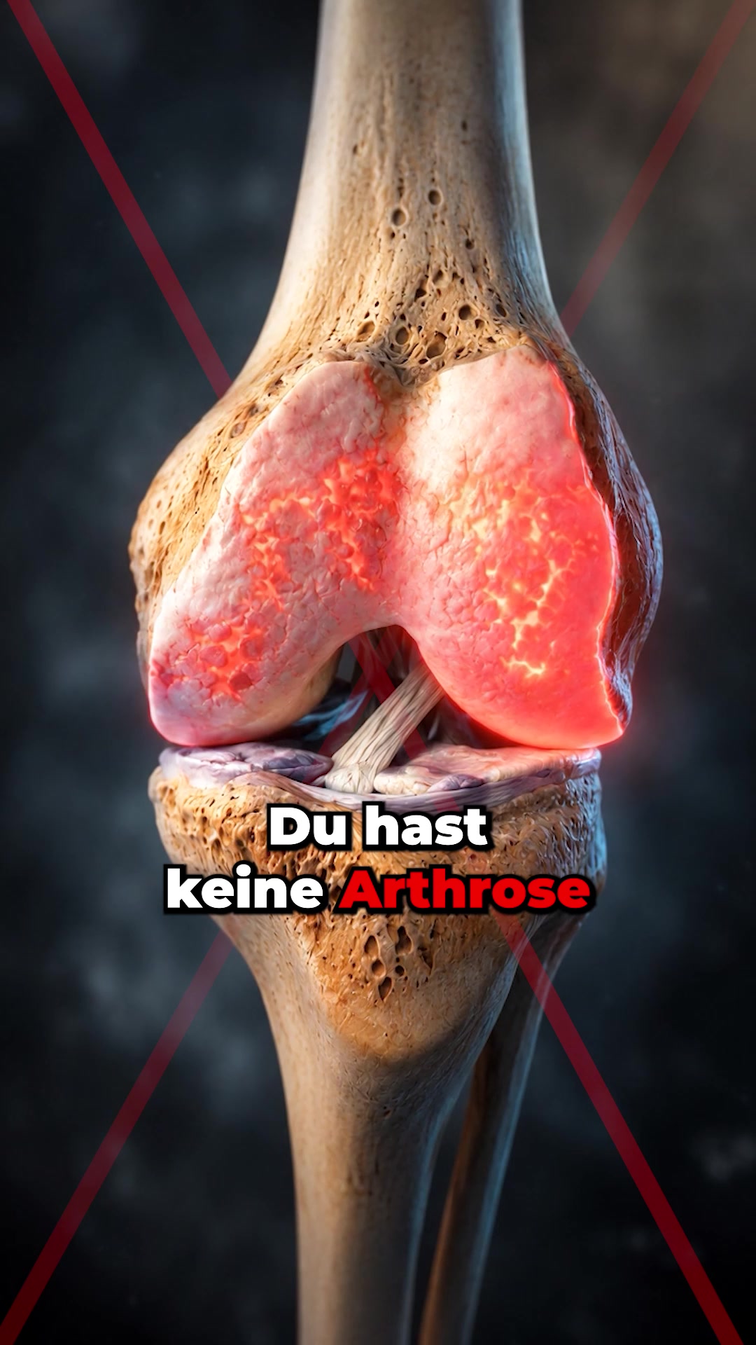 Knieschmerzen oder Arthrose?