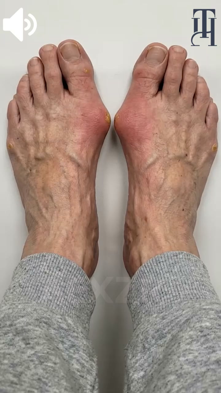 Every step feels like a test?
