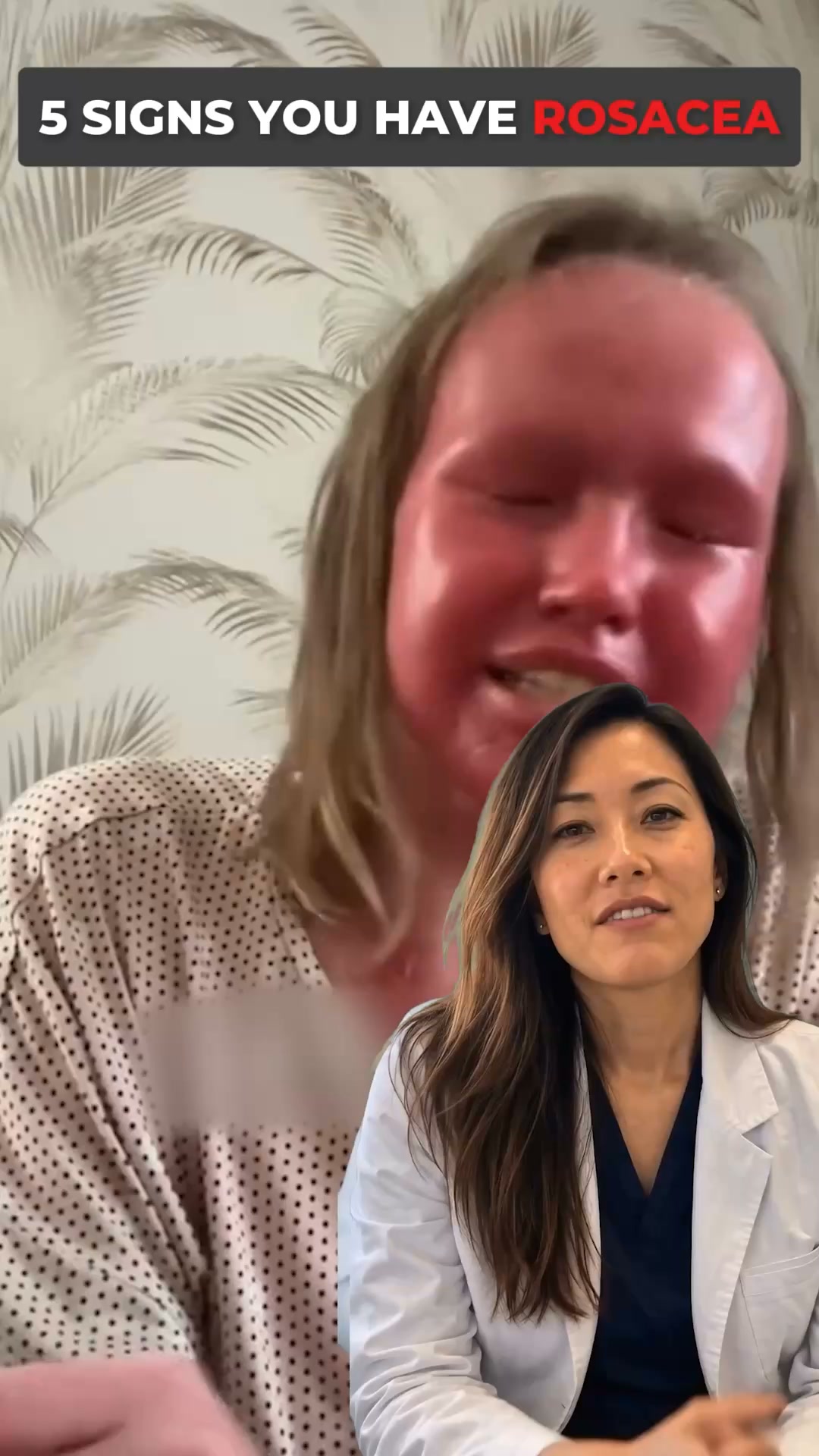 The Rosacea Myth: The Real Reason Flare-Ups Keep Coming Back