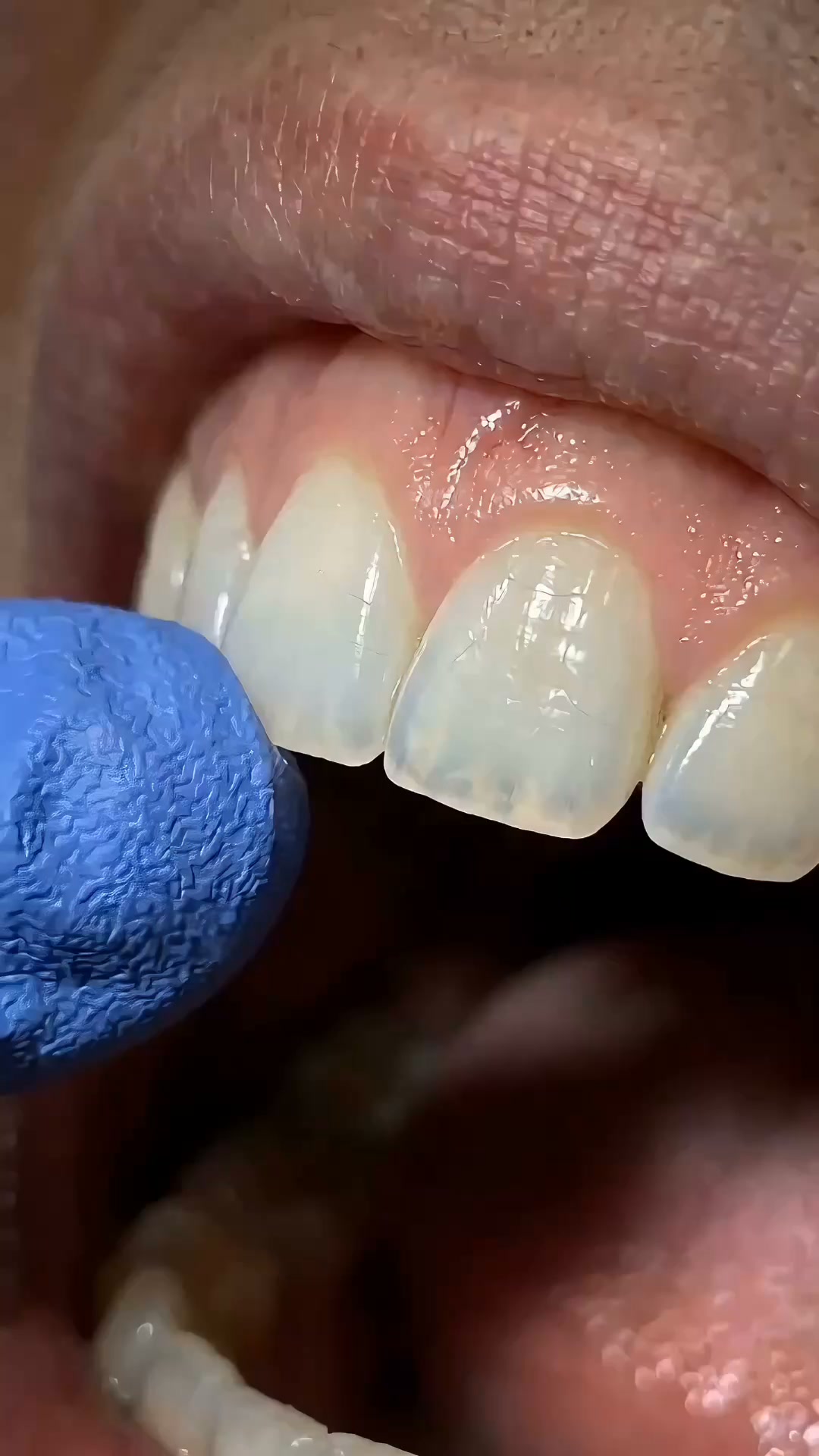 1 chewing-gum qui change vos dents.