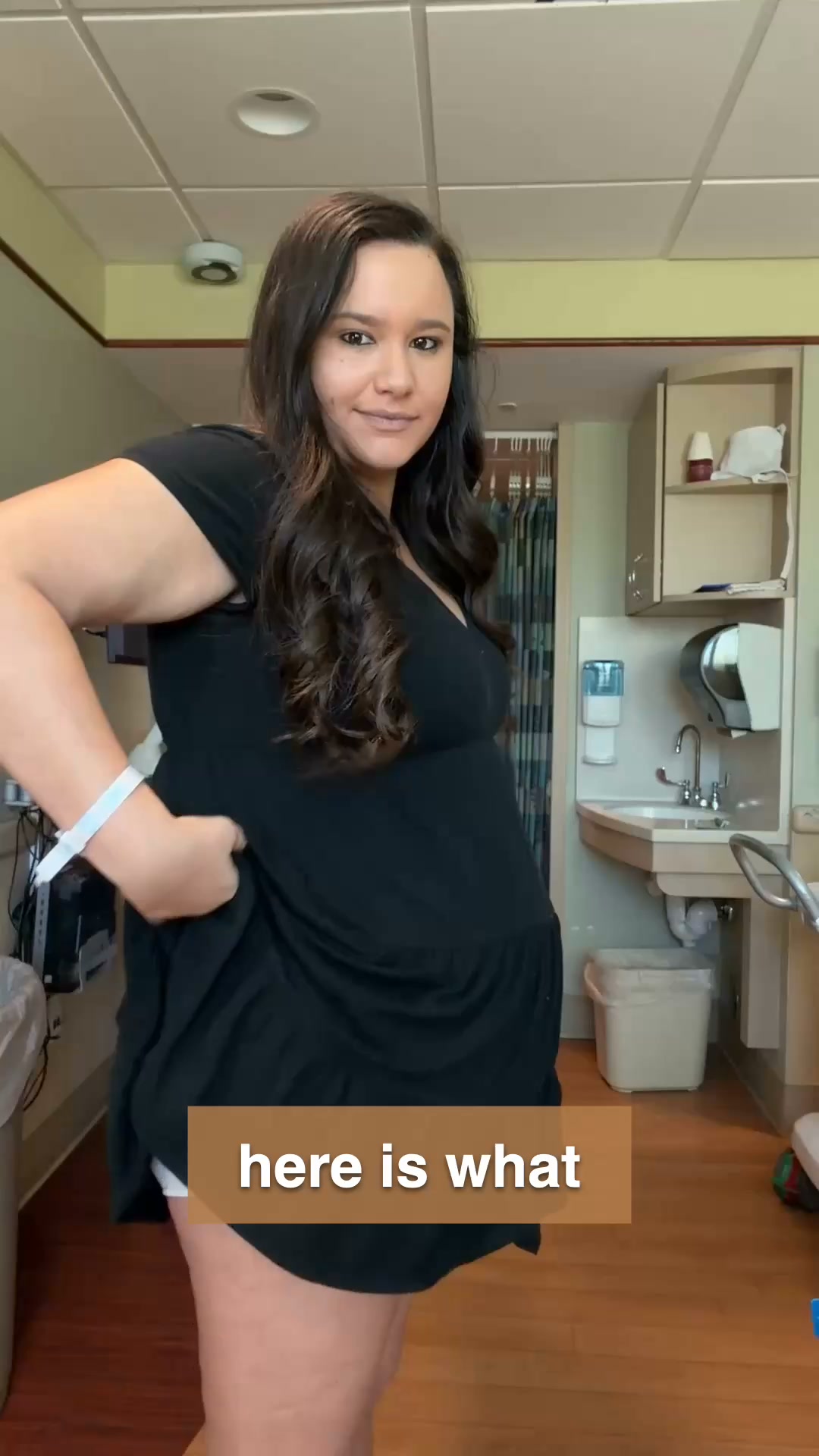 That shelf above your scar is not fat.