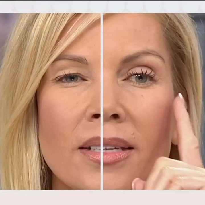 Natural Invisible Eyelid