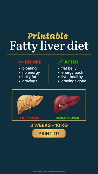 Start Liver Detox today!
