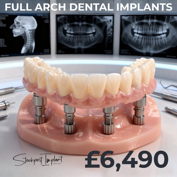 Full Arch Dental Implants From £6,490