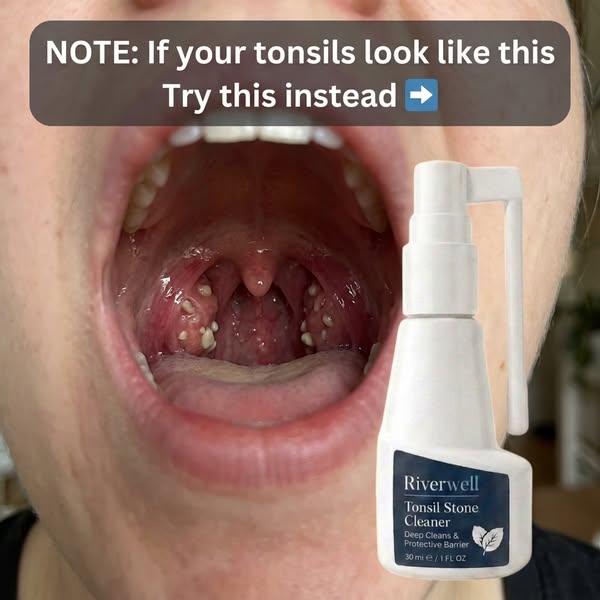 Why brushing doesn't fix this