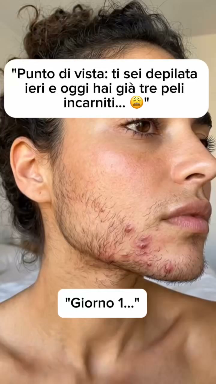 Addio peli sul viso