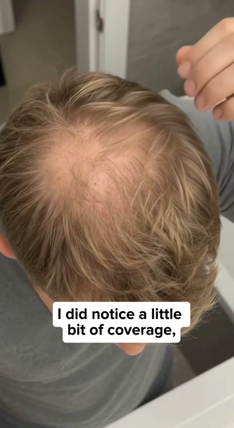 Korea's Secret To Fuller, Thicker Hair