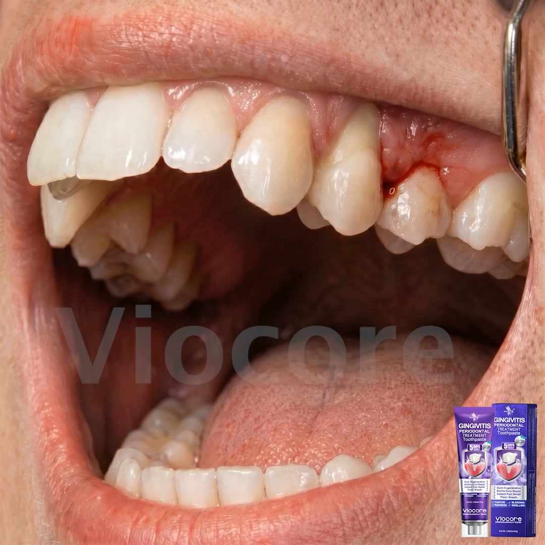 Gum Healing Endorsed by the British Dental Association (BDA) | Delivery within 2-4 working days | Full refund guarantee