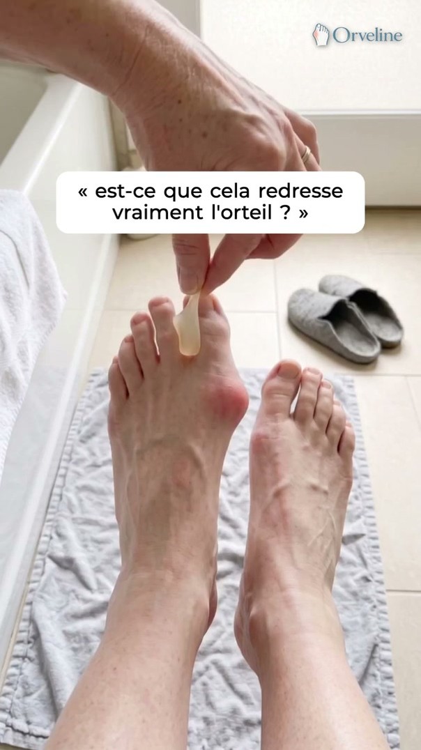 Après l'écarteur, le muscle · 60 jours