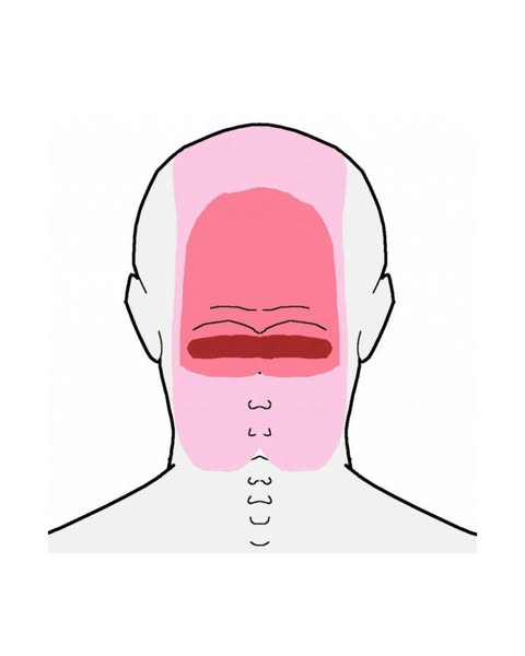 Every Morning: Hand At The Base Of My Skull. Testing Whether I Can Turn My Head Without A Spasm. Most Mornings, No.