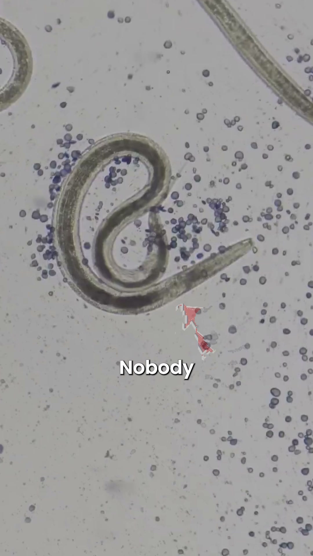 1 in 3 Kids Have Parasites. Most Moms Never Know.