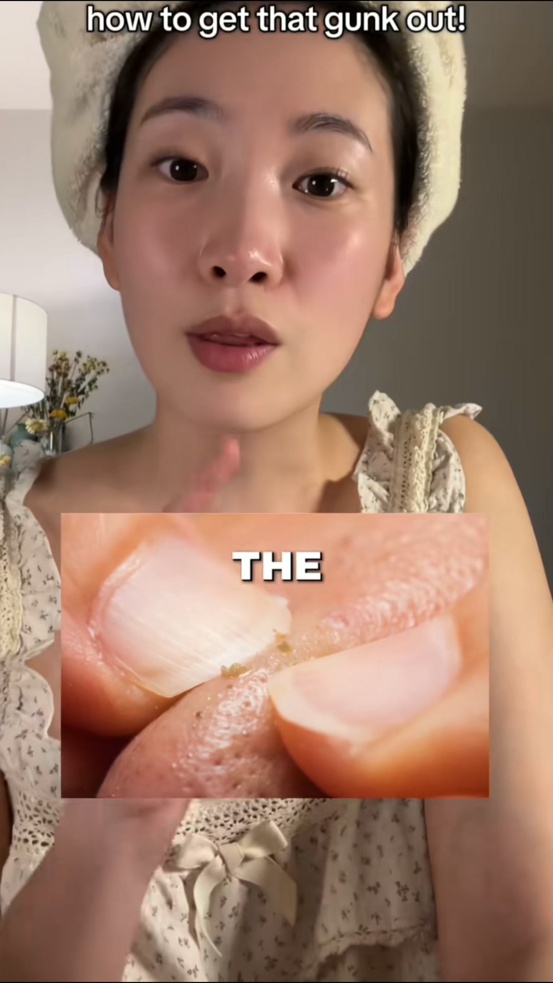 Eliminate Blackheads - Fast