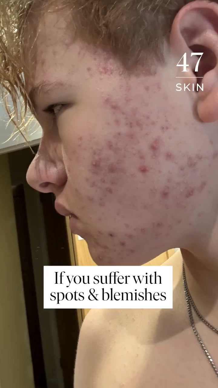 A skin treatment that actually works
