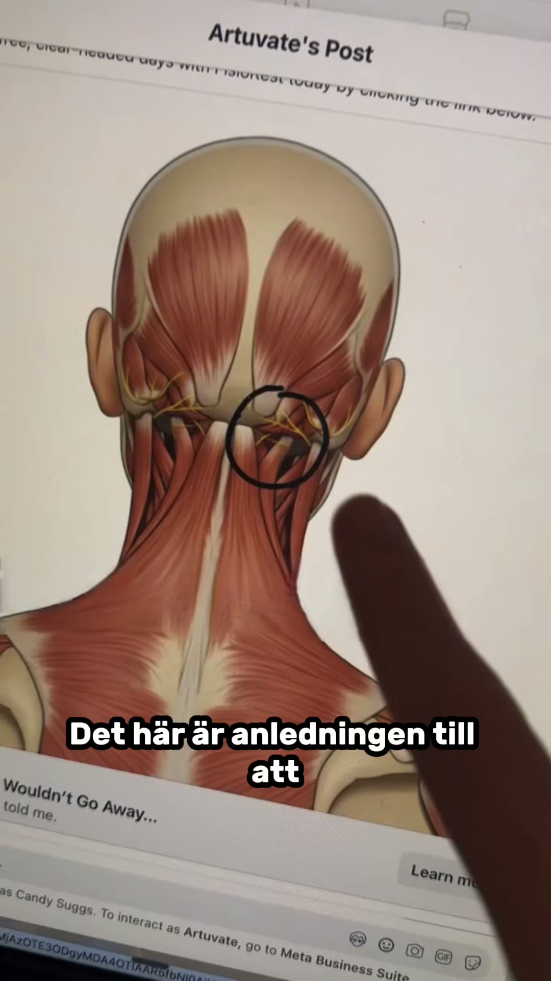 Lindra smärtan i nacken