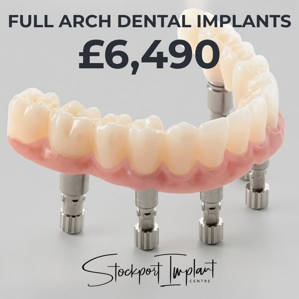 Full Arch Dental Implants From £6,490
