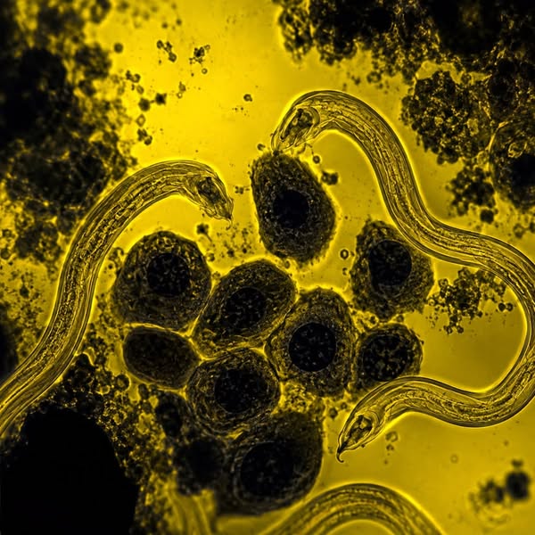 La Bible nous avait prévenus sur les parasites il y a des millénaires