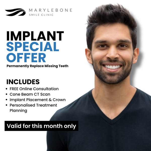 Premium Dental Implants From Just £2995! 15 Spots Only