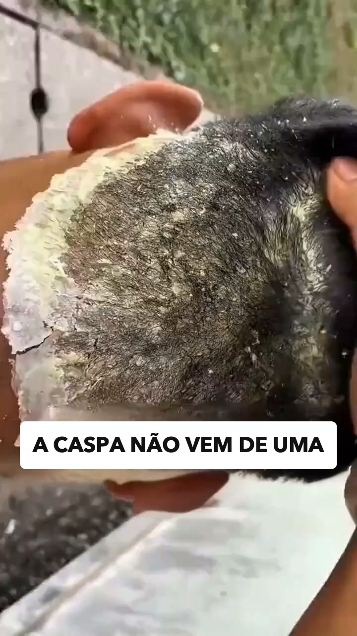 Parasitas, vírus, cansaço crónico