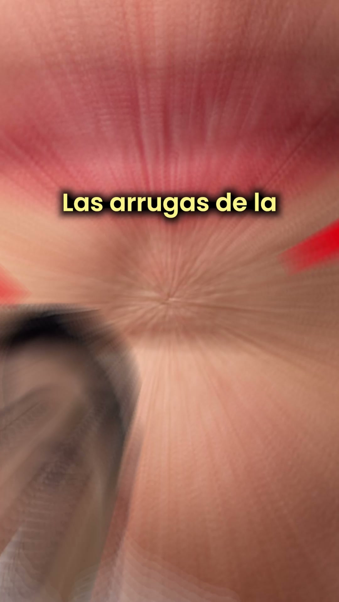 Descubre la micro-infusión Renovae