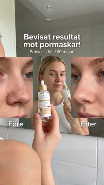 Känn dig bekväm med din hud igen