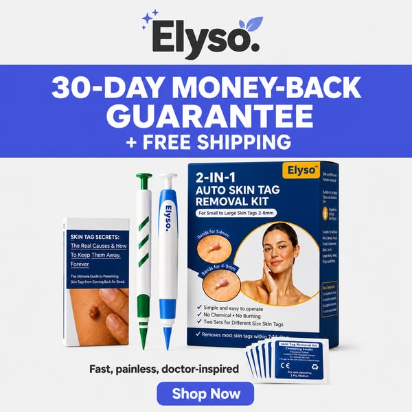 60% OFF Skin Tag Solution