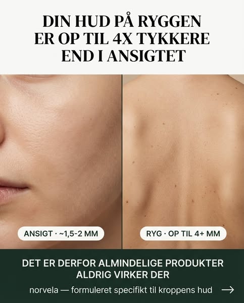 4x tykkere hud — helt anden løsning