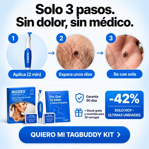 Envío gratis a España · 90 días de garantía