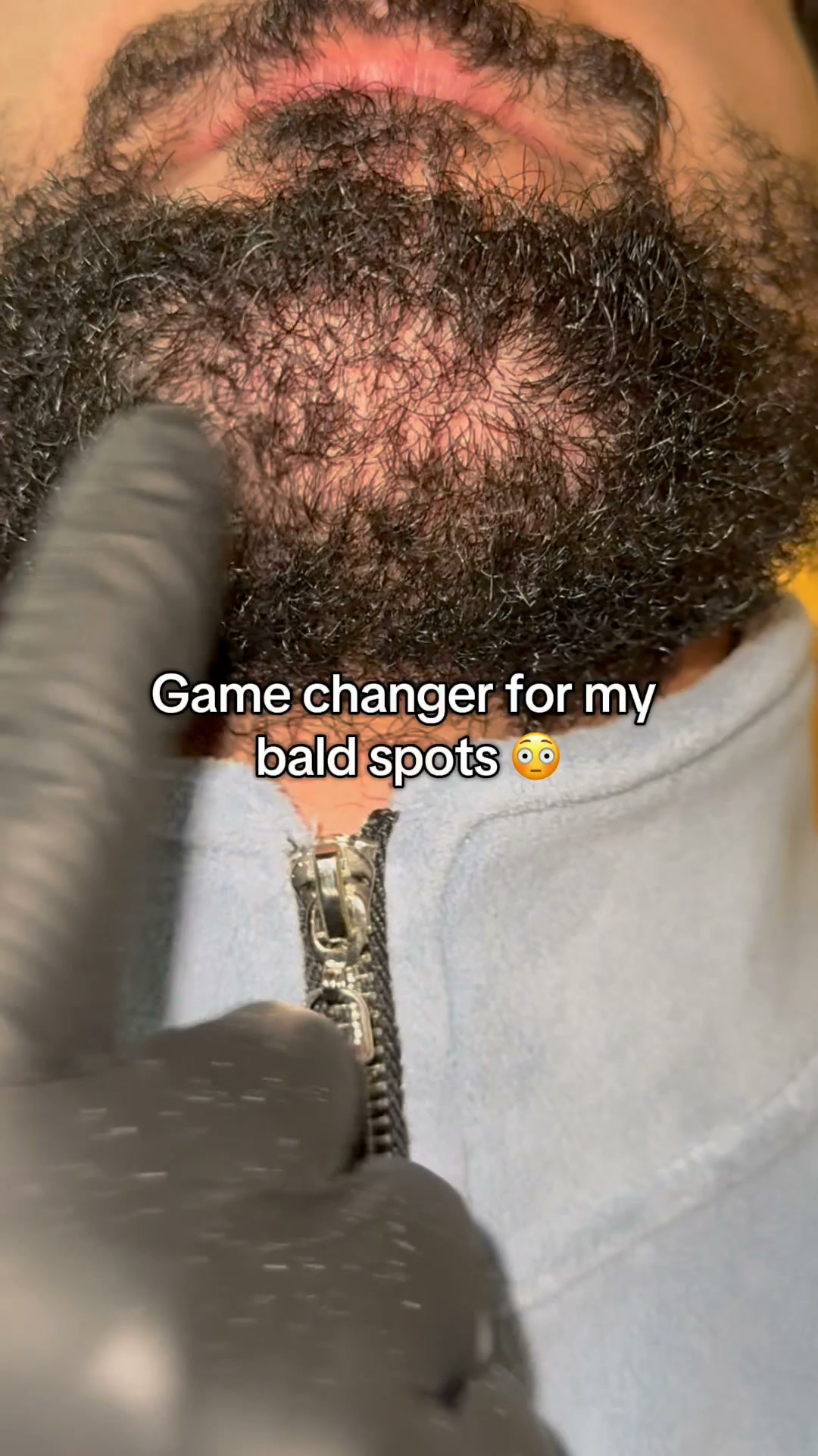 Regrow Fuller Hair - From the Root!