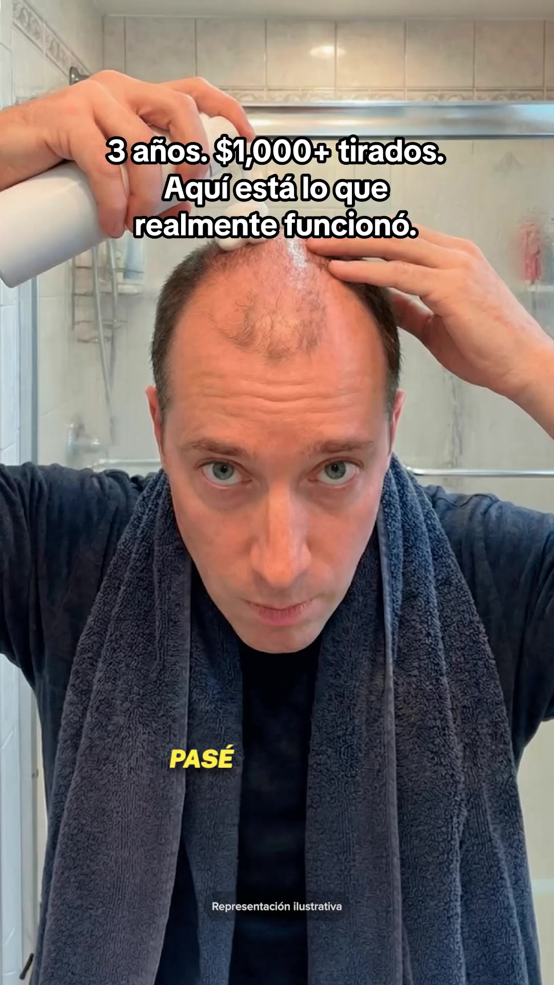 Regrowth Can Be Easy