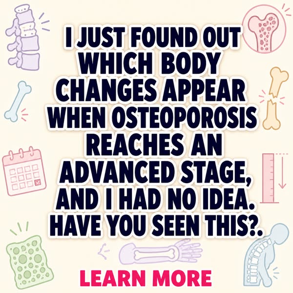 Advanced Osteoporosis: Physical Changes Explained