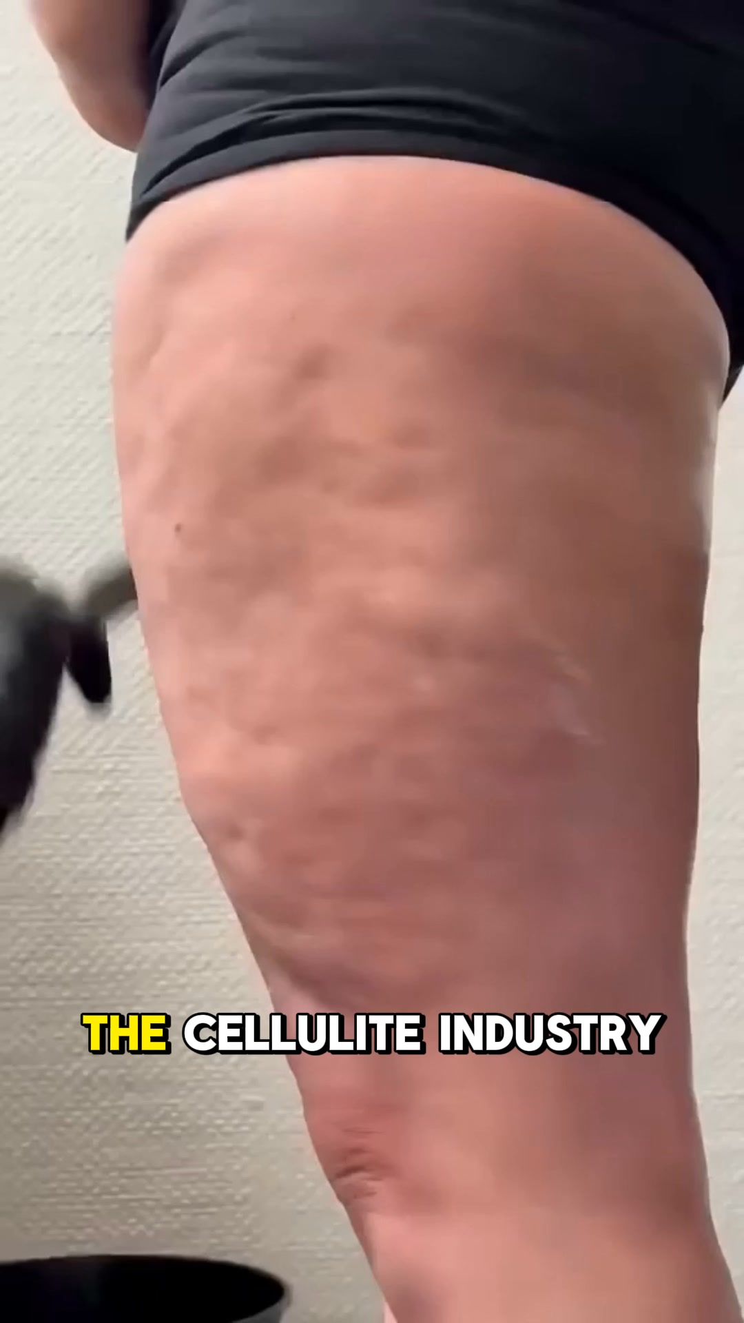 Cellulite isn't fat. It's a missing protein.