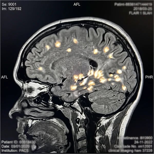 I was 40 minutes from paying $28,400 for stem cells