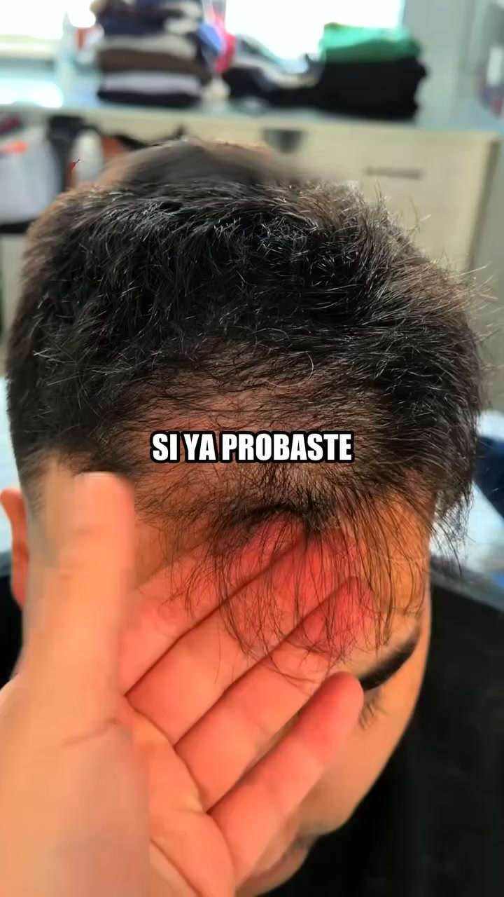 Cabello Más Abundante y Fuerte