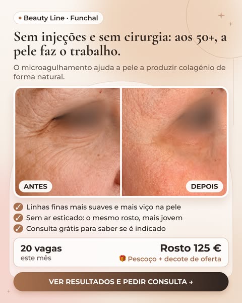 Resultados reais e consulta grátis