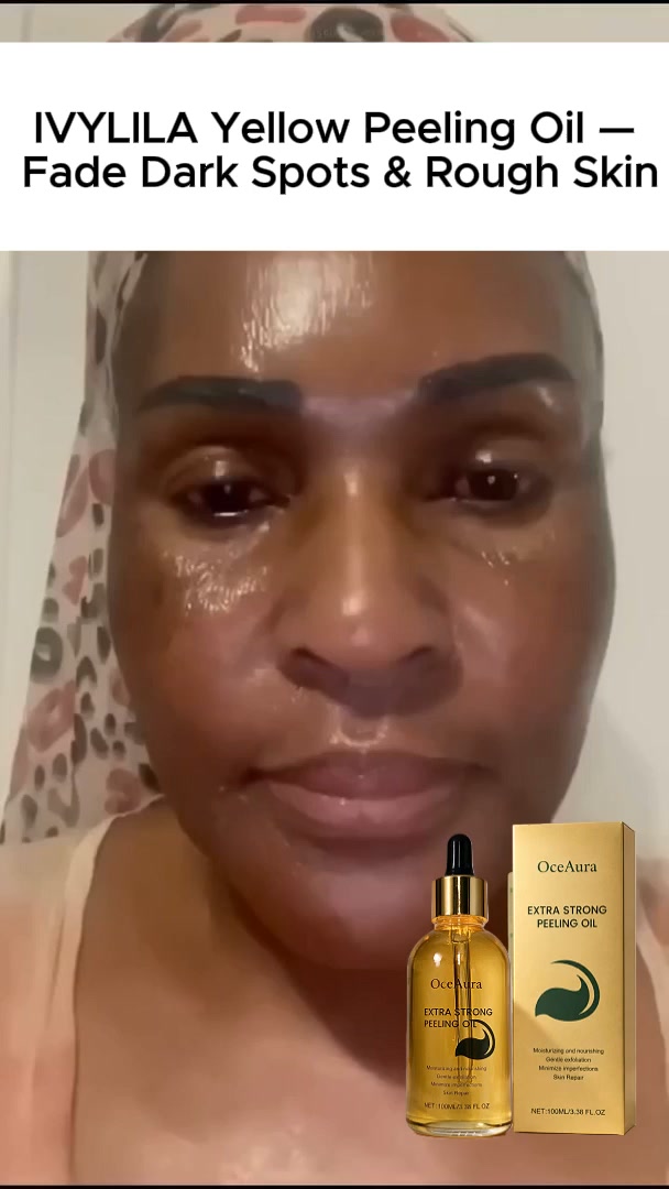 Are you tired of dealing with rough, dry and cracked skin on your hands?