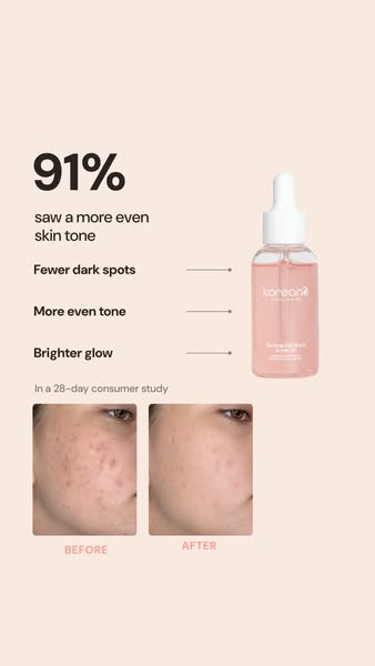 91% zag egalere huid