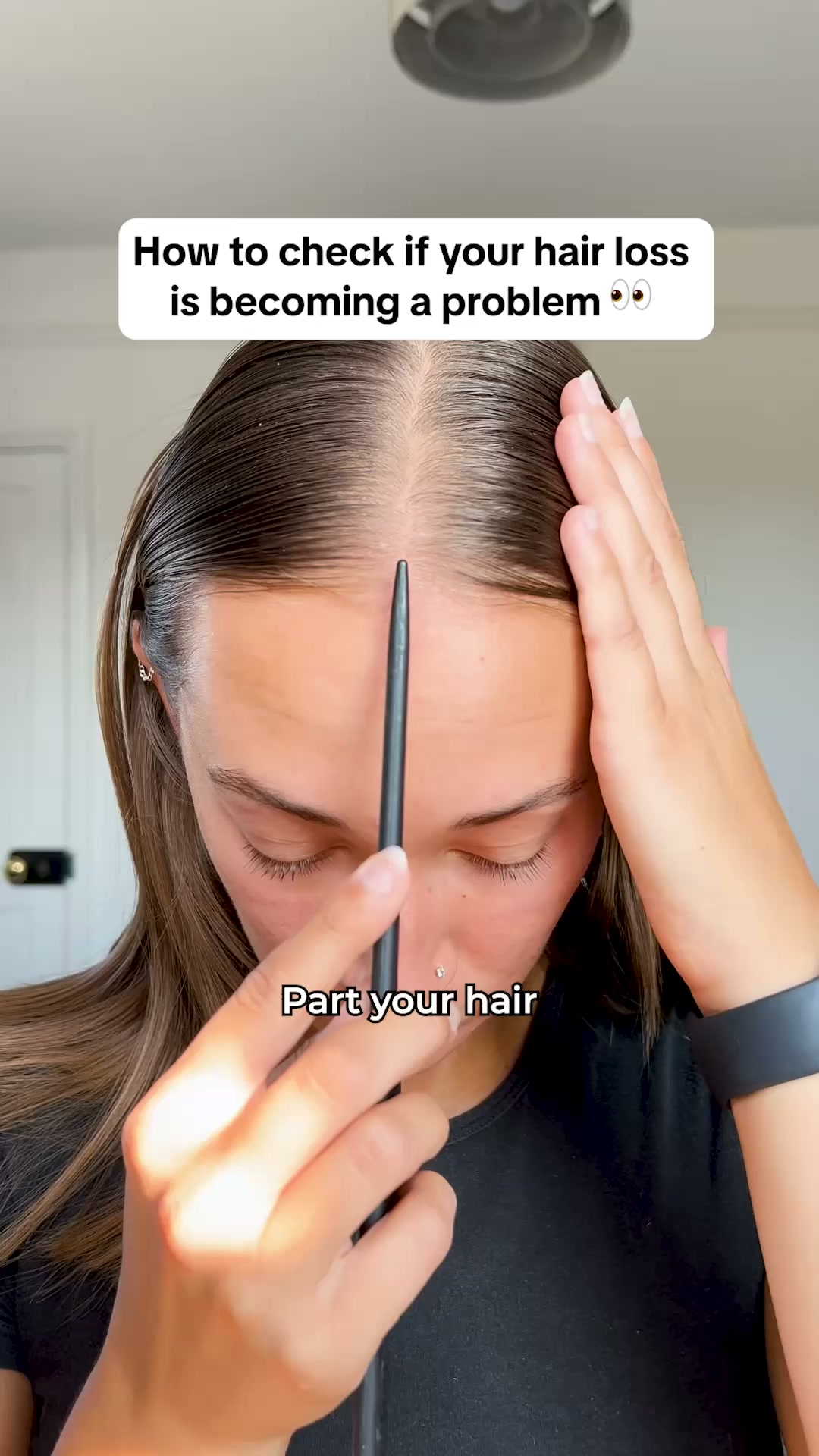 Hair Regrowth Starts Here