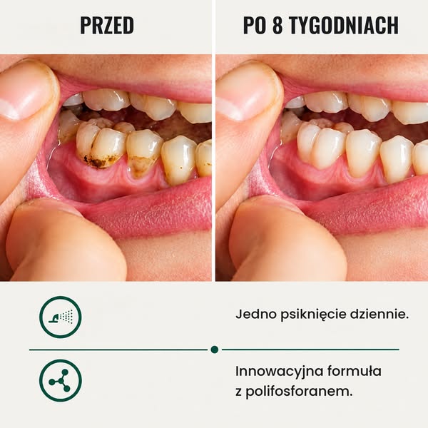 Dlatego pasta do zębów nigdy tak naprawdę nie rozwiązuje problemu nieświeżego oddechu