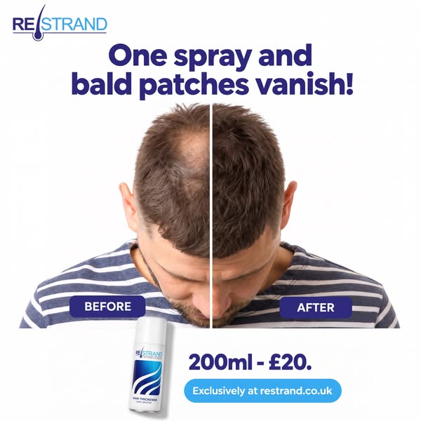 One Spray, Bald Patches Vanish