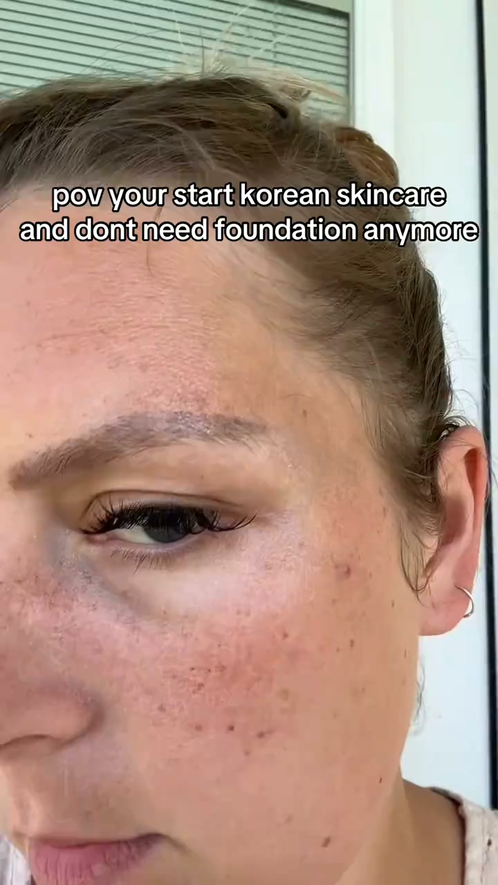 5 reasons this cream works when others didn't.