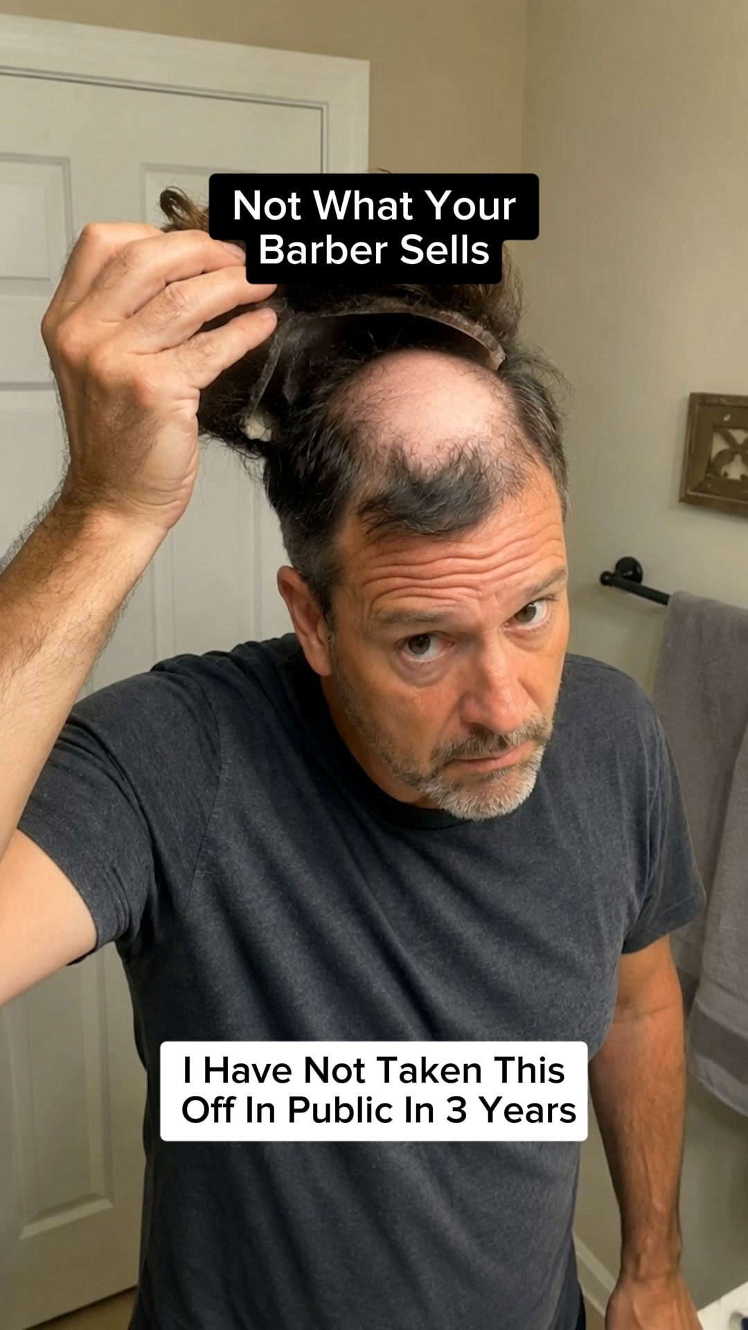 Korean Hair Growth Bar — Stop Hair Loss With 12 Herbs