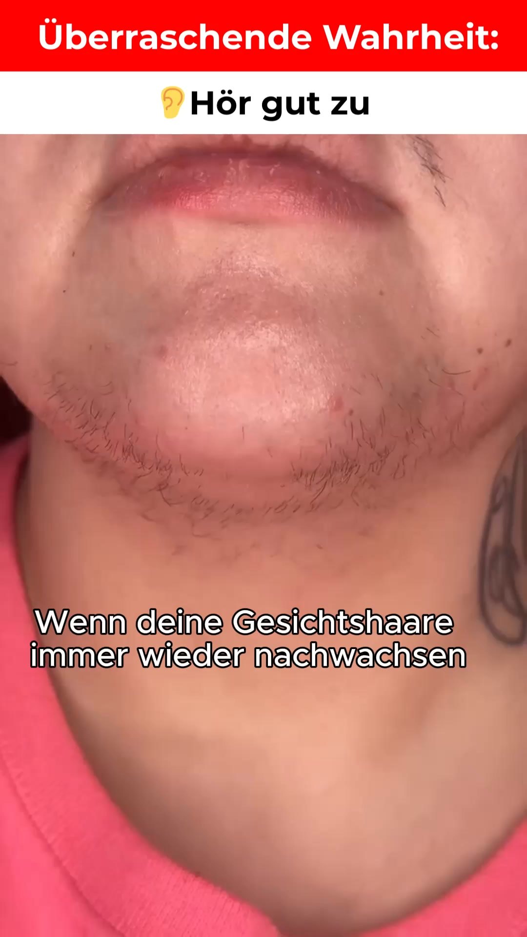 Heute rasiert, morgen wieder da — bis du das Signal an der Wurzel unterbrichst.