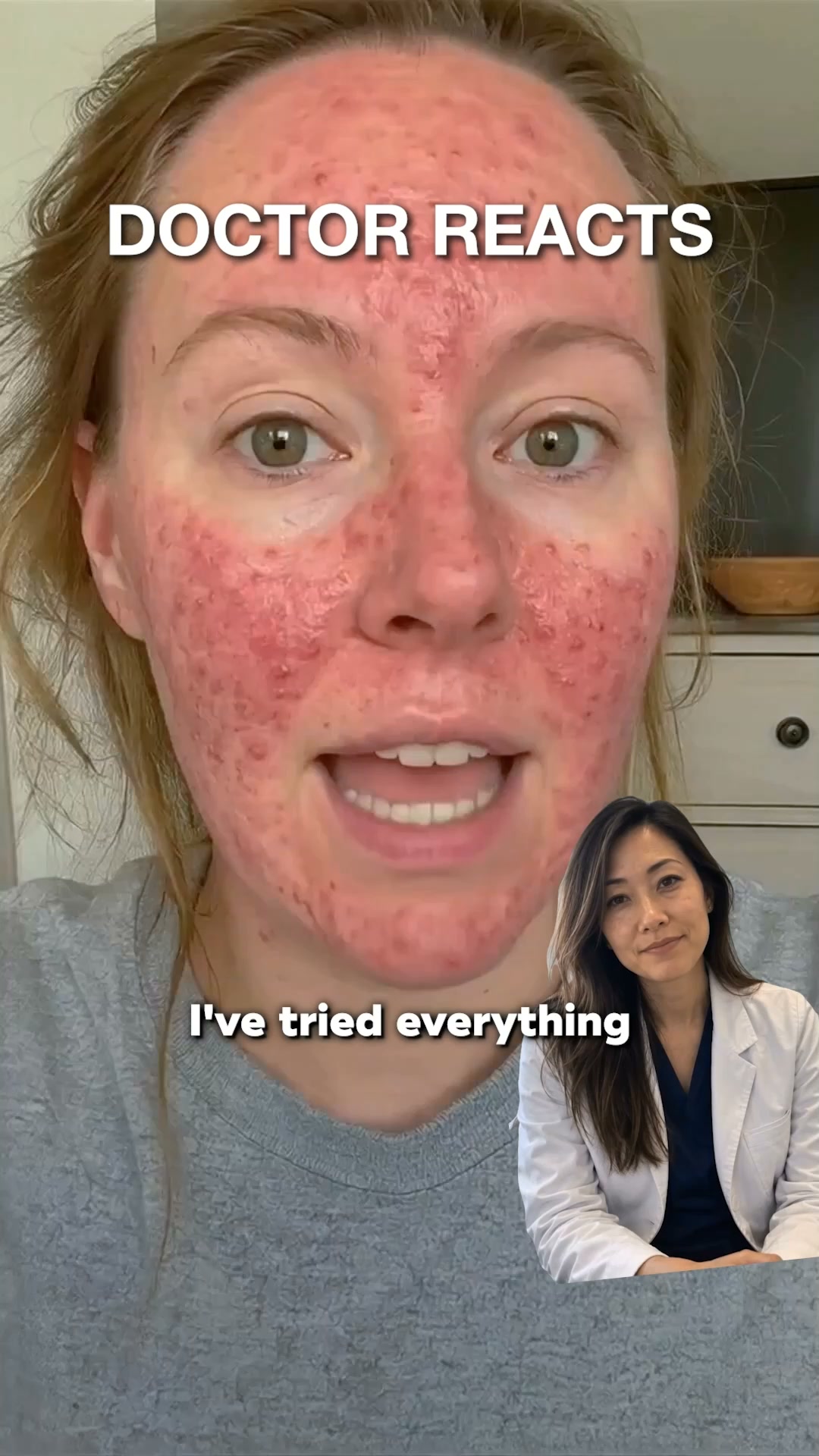 The Rosacea Myth: The Real Reason Flare-Ups Keep Coming Back