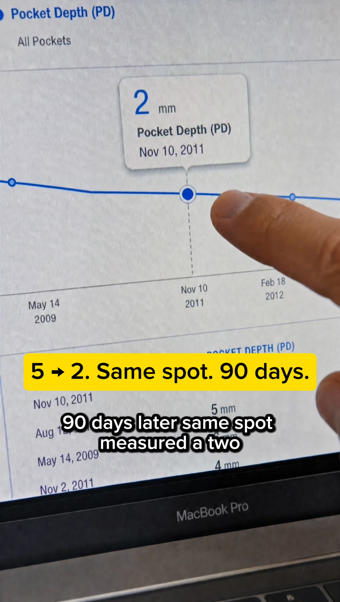 A calmer routine for changing gums