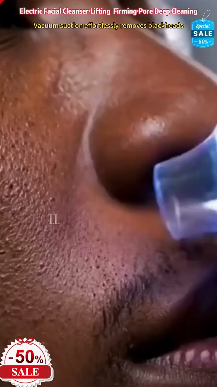 Say Goodbye to Blackheads! Powerful Pore Cleaner – Skin Care Made Easy!