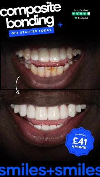 Transform your smile today