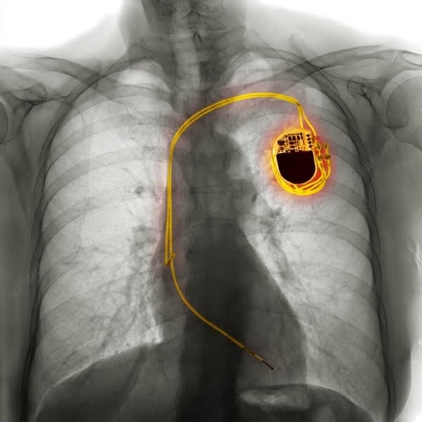 What your GP isn't telling you about cholesterol.