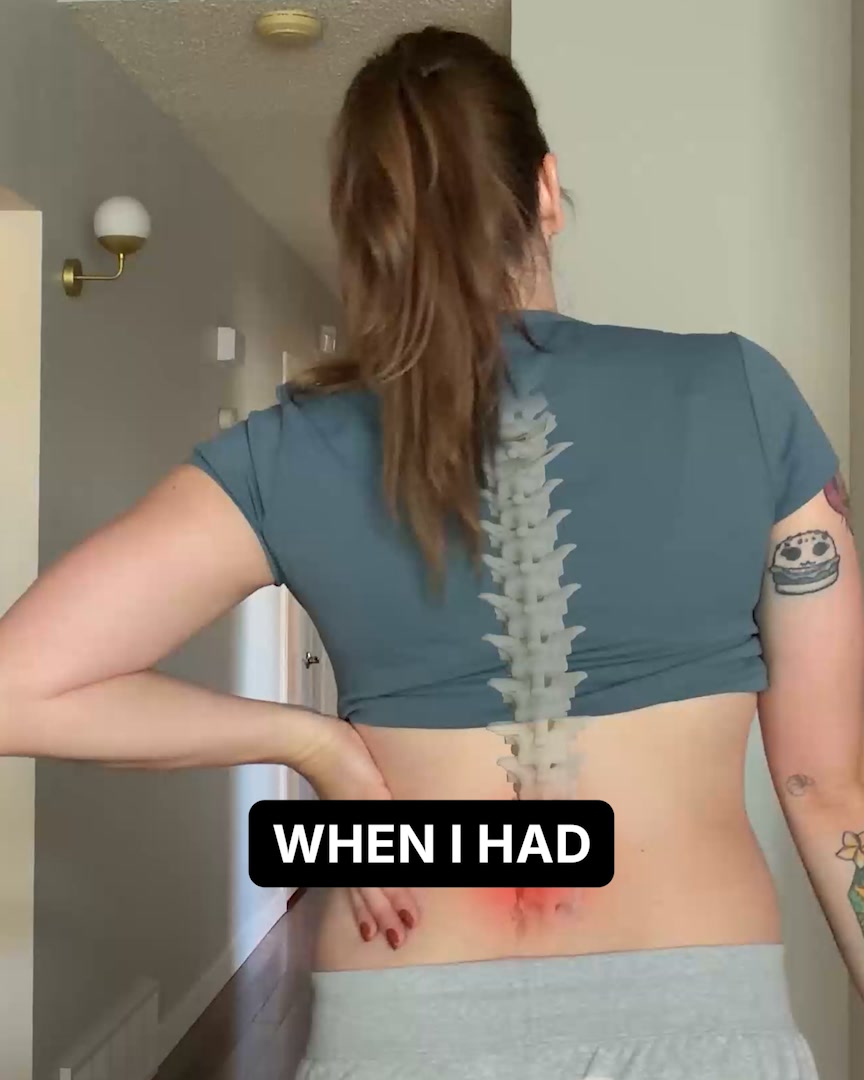 The MRI shows discs and bones but skips this muscle