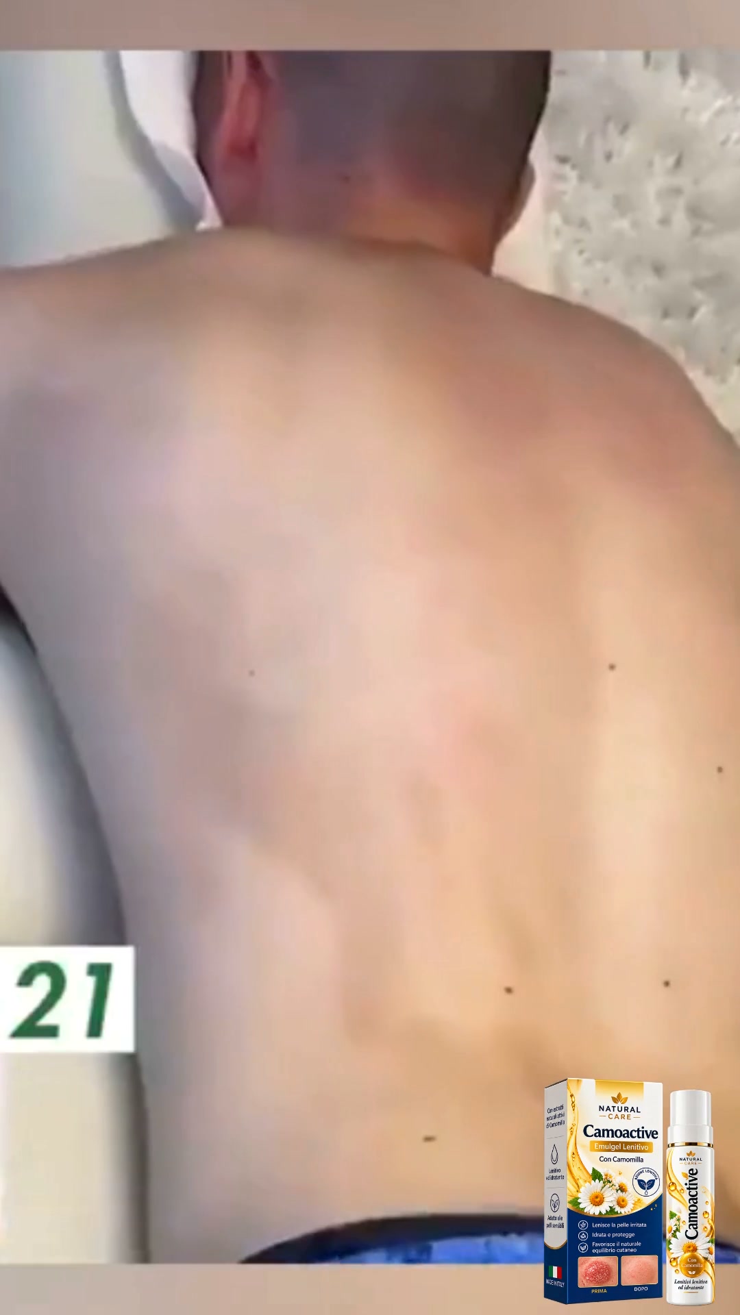 Ho speso €1.800 in 4 anni per la psoriasi. Poi ho trovato qualcosa che costa €49.